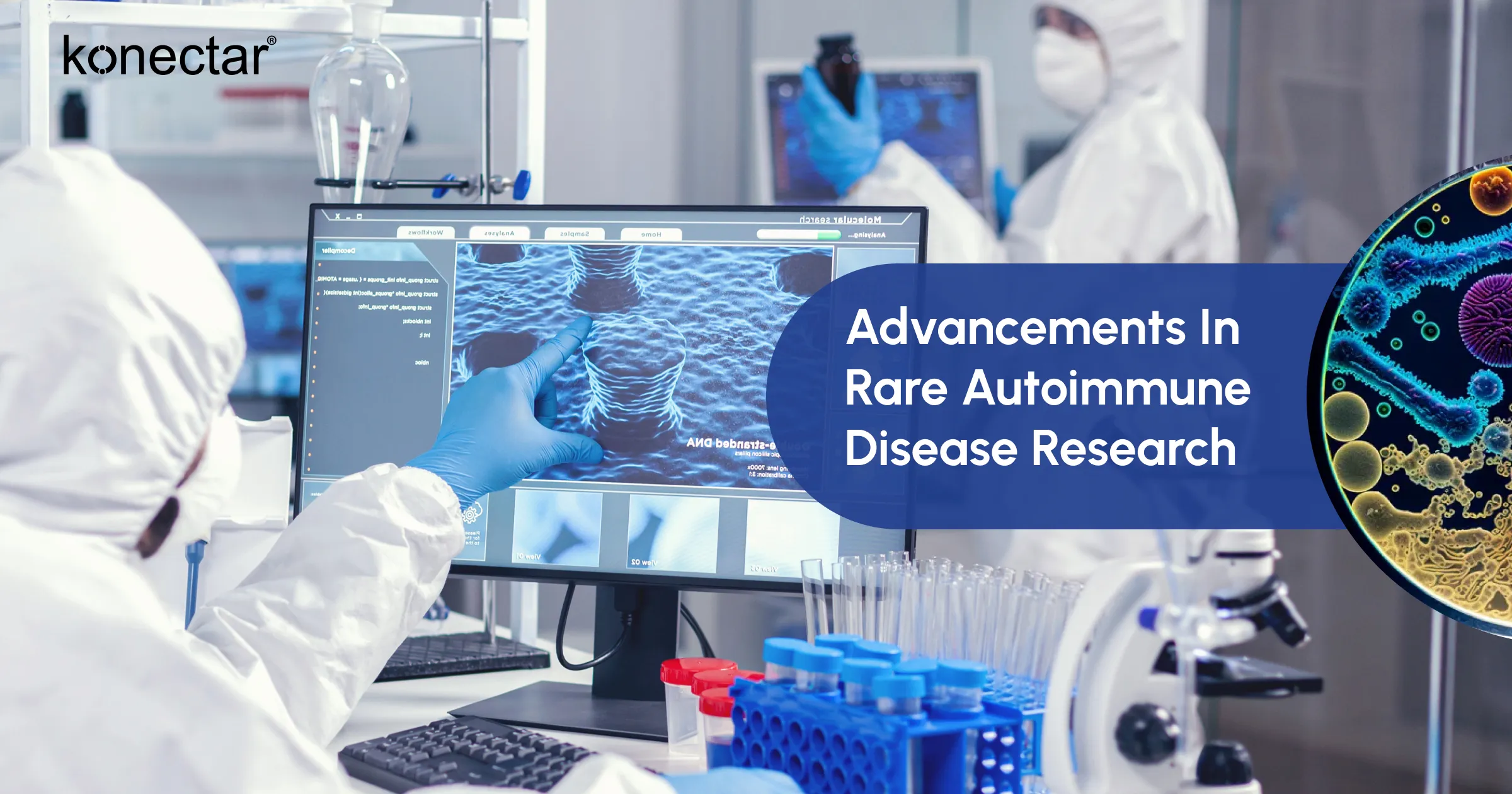 Advancements in Rare Autoimmune Disease Research